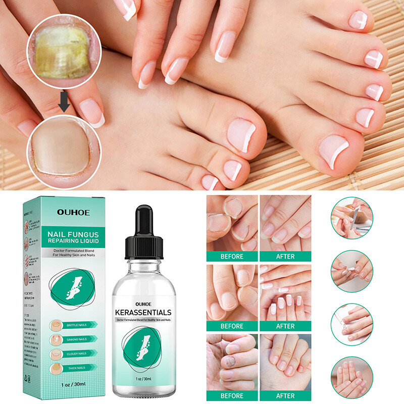 kerassentials benefits